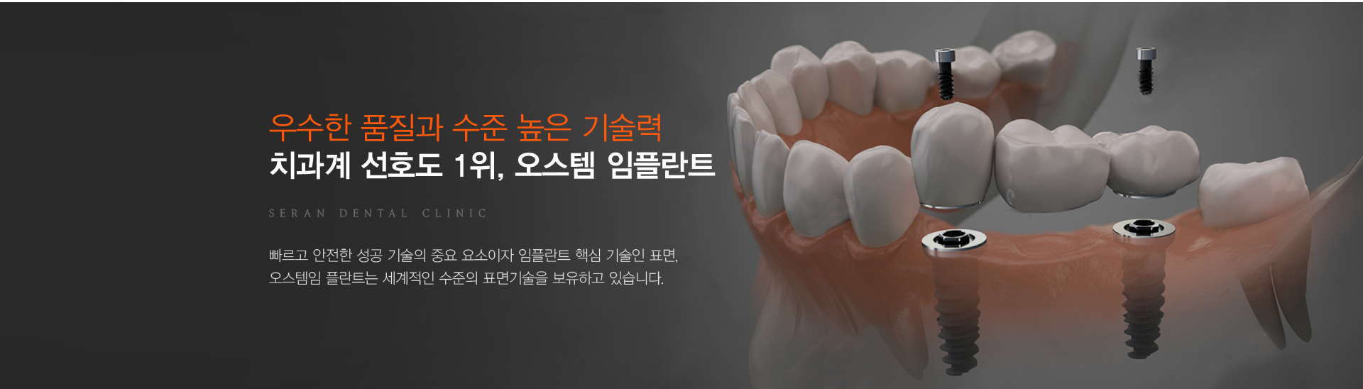 빠르고 안전한 성공 기술의 중요 요소이자 임플란트 핵심 기술인 표면,
오스템임 플란트는 세계적인 수준의 표면기술을 보유하고 있습니다.