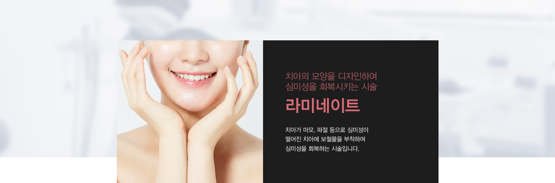 치아의 모양을 디자인하여 심미성을 회복시키는 시술 라미네이트 치아가 마모, 파절 등으로 심미성이 떨어진 치아에 보철물을 부착하여 심미성을 회복하는 시술입니다.