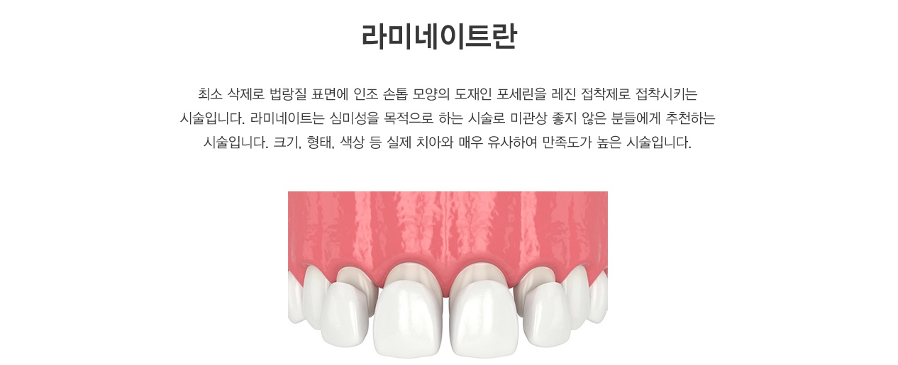 라미네이트 장점 기존에 가지고 있는 치아를 최대한 보존할 수 있습니다. 연예인, 방송인, 서비스직에 종사하시는 분 등
외모가 중요한 분들이 많이 받는 시술입니다.