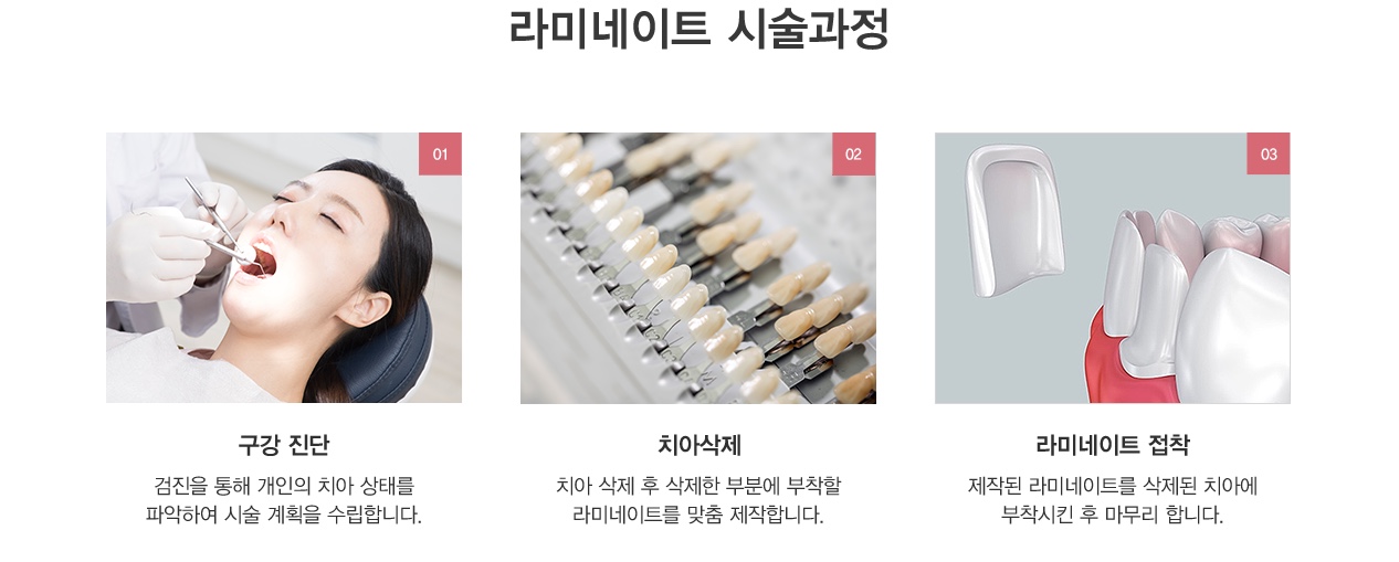 라미네이트 장점 기존에 가지고 있는 치아를 최대한 보존할 수 있습니다. 연예인, 방송인, 서비스직에 종사하시는 분 등
외모가 중요한 분들이 많이 받는 시술입니다.