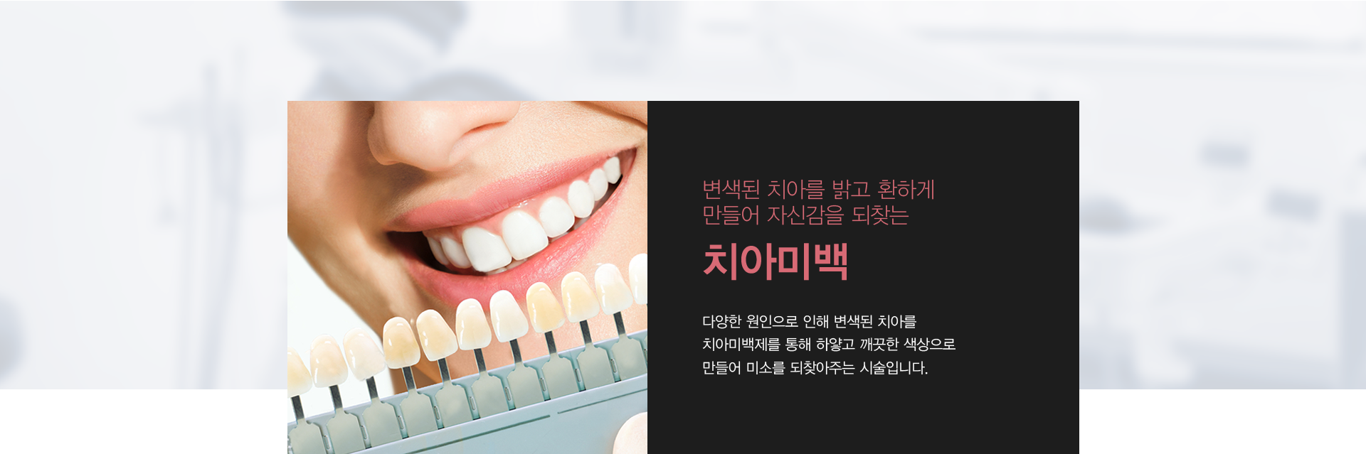변색된 치아를 밝고 환하게 만들어 자신감을 되찾는 치아미백 다양한 원인으로 인해 변색된 치아를
치아미백제를 통해 하얗고 깨끗한 색상으로 만들어 미소를 되찾아주는 시술입니다.