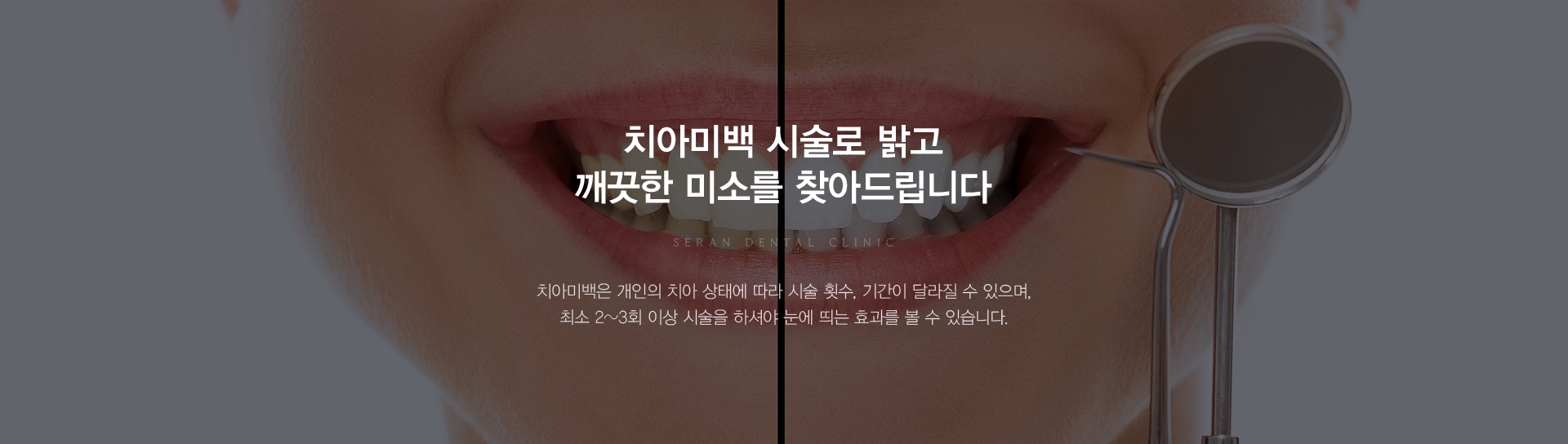 치아미백 시술로 밝고 깨끗한 미소를 찾아드립니다