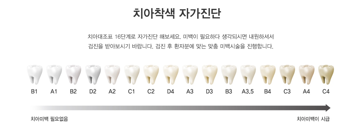 치아착색 원인